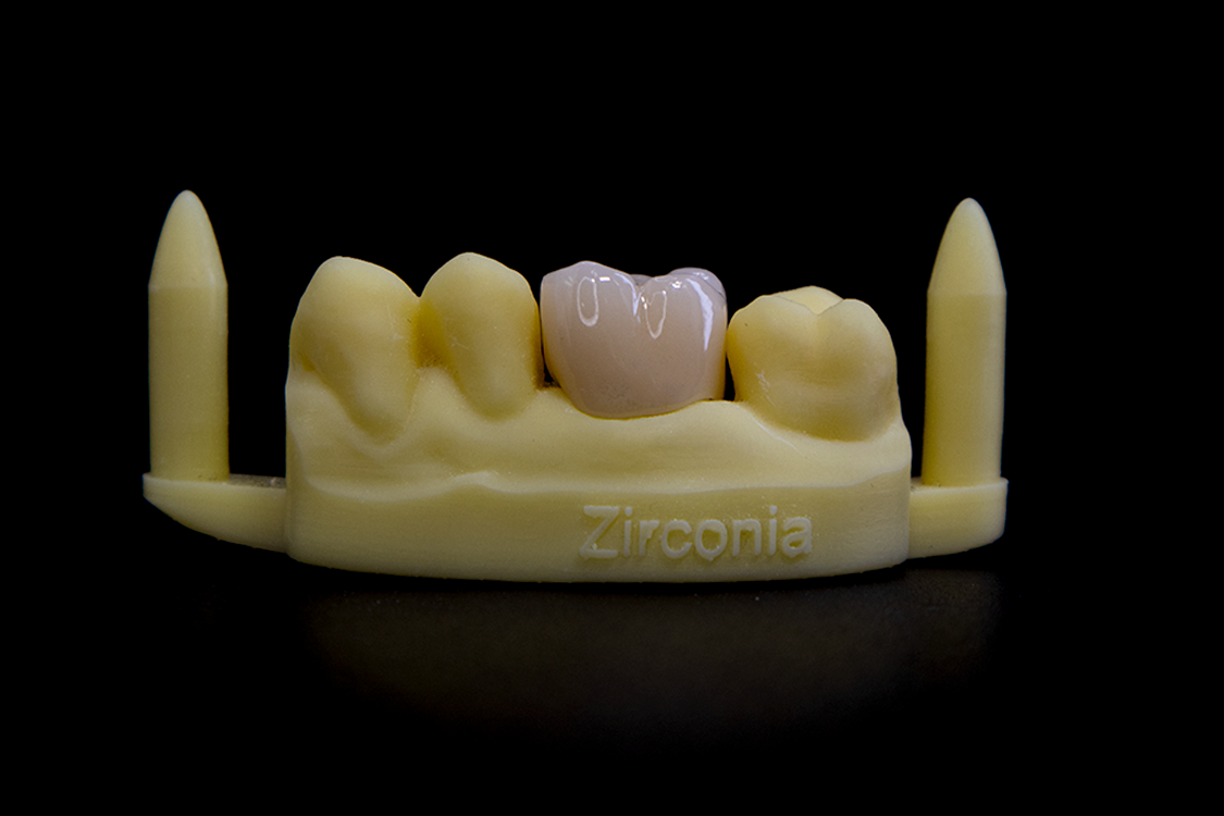 zirconia 1
