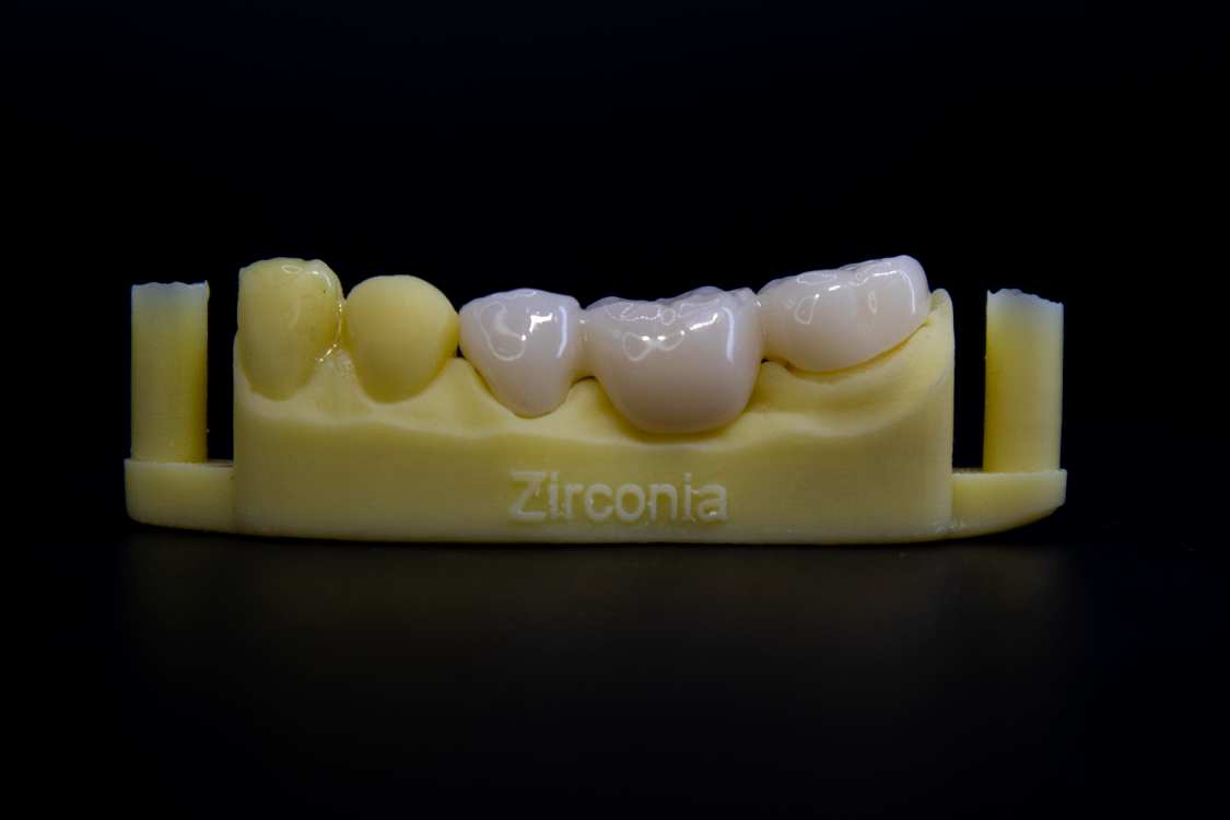 zirconia 1